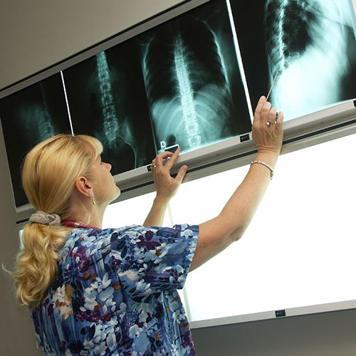 woman looking at xrays on screen