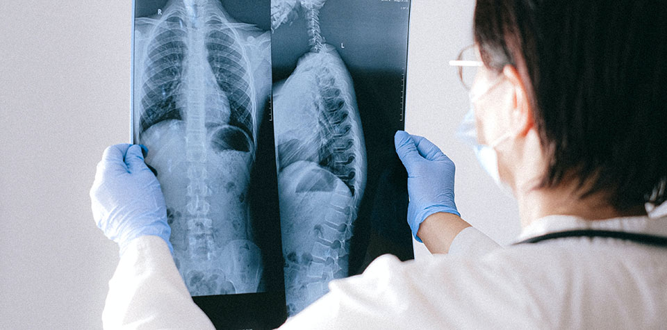 A radiographer is looking at an xray image