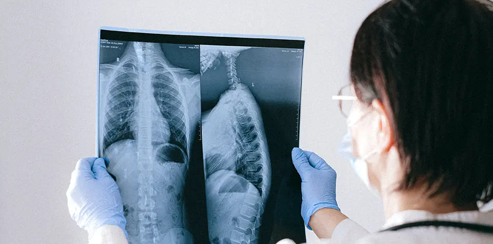 A female radiographer is looking at an xray